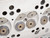 Complete Cylinder Head Basic Replacement Kit | ES2918768