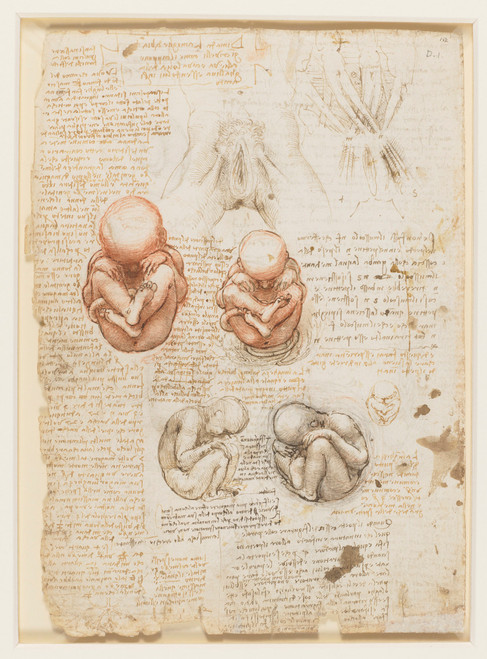 Studies of Fetus and Wombs - Leonardo Da Vinci