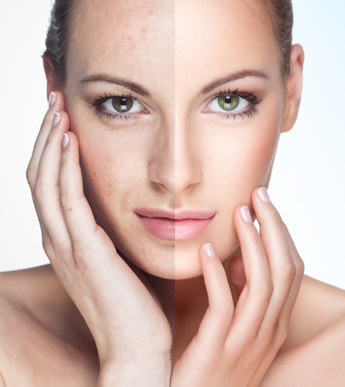 How to Take the Best Before and After Beauty Photos