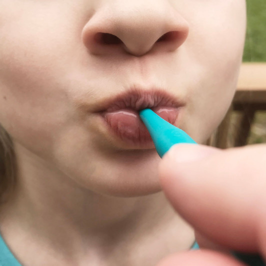 Ark's ProButton Set for Lip Closure/Strength