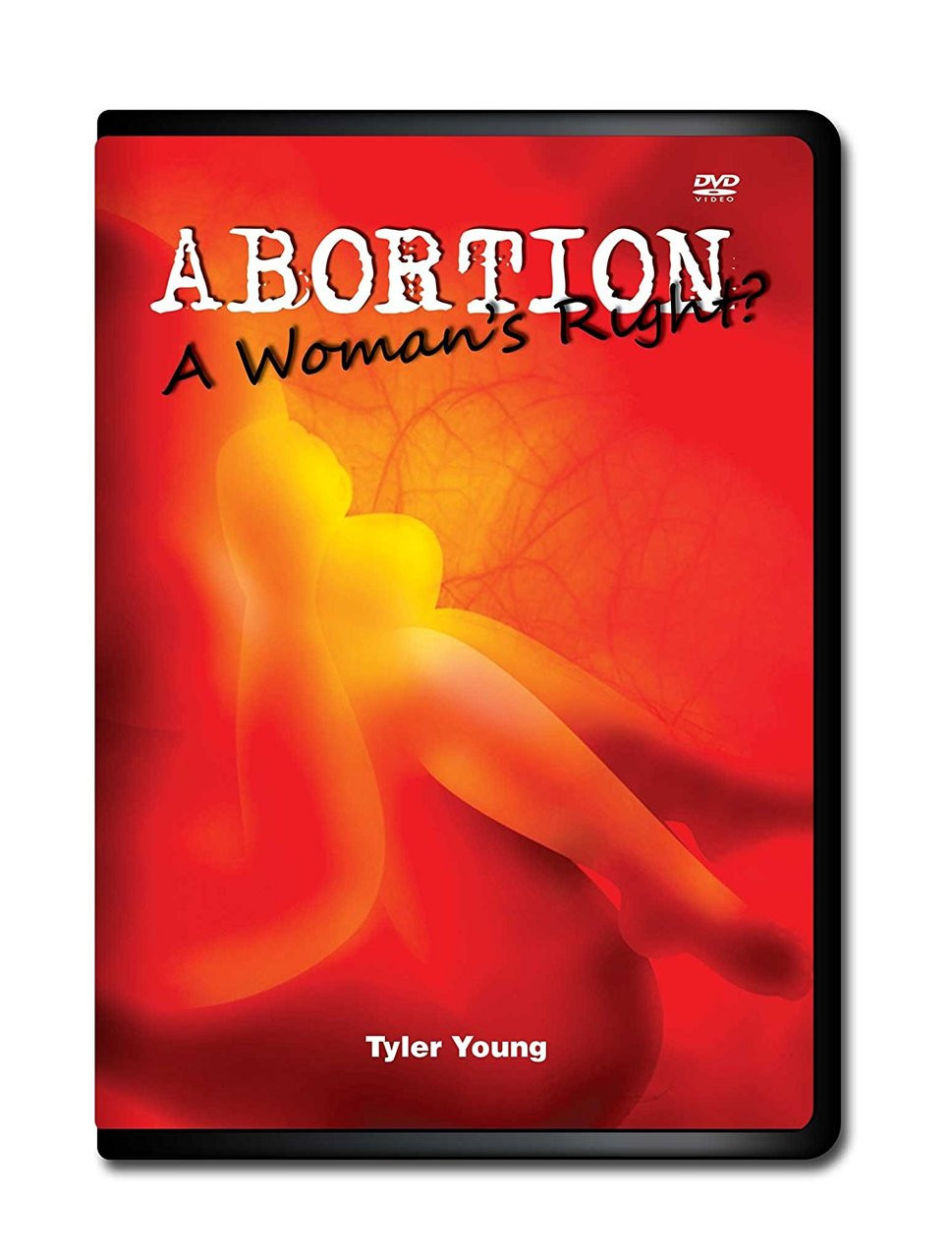 Abortion, A Woman's Right?