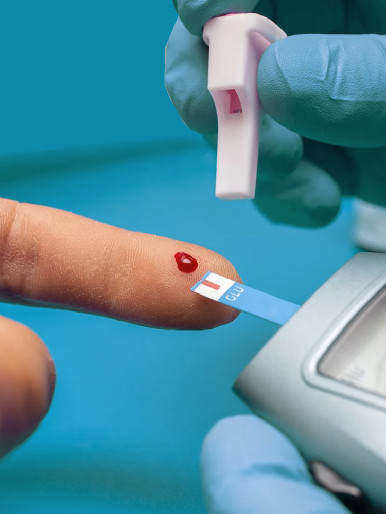 Analíticas en la Farmacia Petra en Madrid Río