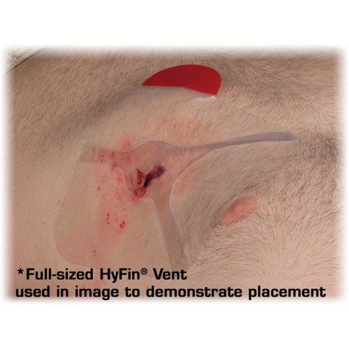 Hyfin Compact Vented Chest Seals North American Rescue Hyfin Compact Vented Chest Seals North American Rescue