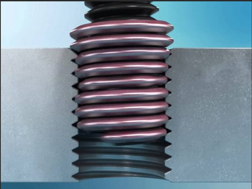 4-40 UNC Screw-Lock Screw Thread Insert.