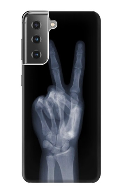 S3101 X-ray Peace Sign Fingers Case For Samsung Galaxy S21 Plus 5G, Galaxy S21+ 5G