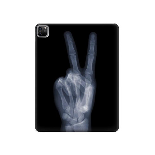 S3101 X-ray Peace Sign Fingers Hard Case For iPad Pro 12.9 (2022,2021,2020,2018, 3rd, 4th, 5th, 6th)