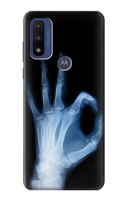 S3239 X-Ray Hand Sign OK Case For Motorola G Pure