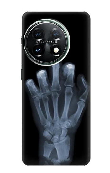 S1143 X-ray Hand Middle Finger Case For OnePlus 11