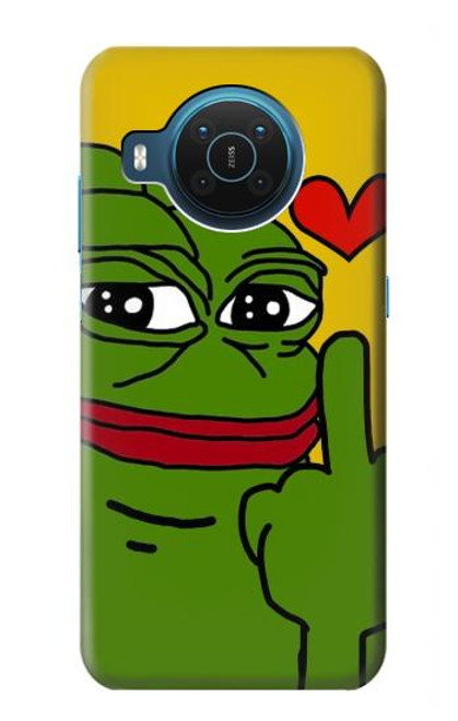 S3945 Pepe Love Middle Finger Case For Nokia X20