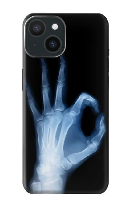 S3239 X-Ray Hand Sign OK Case For iPhone 15