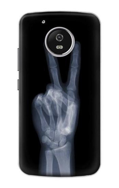 S3101 X-ray Peace Sign Fingers Case For Motorola Moto G5