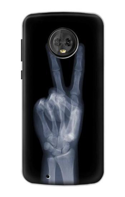 S3101 X-ray Peace Sign Fingers Case For Motorola Moto G6