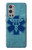 S3824 Caduceus Medical Symbol Case For OnePlus 9 Pro