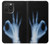 S3239 X-Ray Hand Sign OK Case For iPhone 15 Pro Max