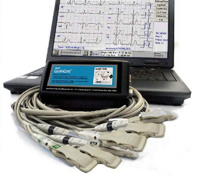 CardioCard PC Based EKG with Interpretation | Nasiff EKG