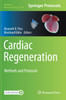 Cardiac Regeneration