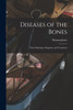 Diseases of the Bones