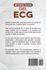 Interpretación del ECG