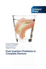 Post Insertion Problems In Complete Denture