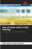 Use of stem cells in skin healing