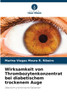 Wirksamkeit von Thrombozytenkonzentrat bei diabetischem trockenem Auge