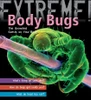 Body Bugs: The uninvited guests on your body