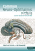 Common Neuro-Ophthalmic Pitfalls