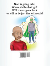 Noel B. Jackson's The "B" is Not For Bald