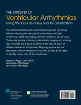The Origins of Ventricular Arrhythmias
