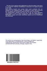 Ocular Prosthesis Ocular Prosthesis