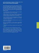 Atlas of Contrast-Enhanced Mammography Atlas of Contrast-Enhanced Mammography