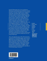 Shaped Beam Radiosurgery Shaped Beam Radiosurgery