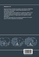 Advances in CT Advances in CT