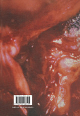 Advanced Intraoperative Technologies in Neurosurgery Advanced Intraoperative Technologies in Neurosurgery
