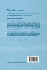 Macular Edema