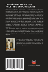 LES DÉFAILLANCES DES FACETTES EN PORCELAINE