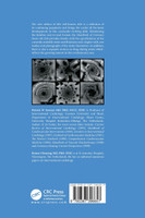 Handbook of Coronary Stents