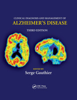 Clinical Diagnosis and Management of Alzheimer's Disease