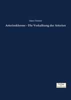 Arteriosklerose - Die Verkalkung der Arterien