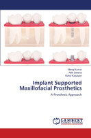 Implant Supported Maxillofacial Prosthetics