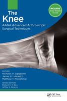 The Knee