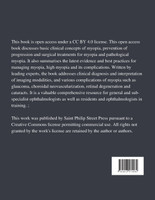 Updates on Myopia