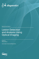 Lesion Detection and Analysis Using Optical Imaging