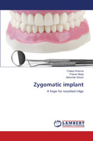 Zygomatic implant