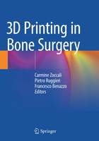 3D Printing in Bone Surgery