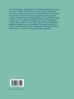 The Veins of the Posterior Fossa