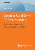 Variation Based Dense 3D Reconstruction