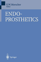 Endoprosthetics