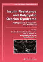 Insulin Resistance and Polycystic Ovarian Syndrome