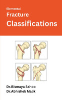Elemental Fracture Classifications